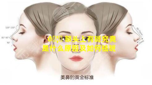 🦉 额头上有斑究竟是什么原因及如何祛斑